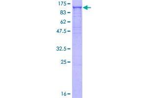 Furin (Paired Basic Amino Acid Cleaving Enzyme) (FURIN) (AA 28-794) protein (GST tag)