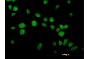 Immunofluorescence of monoclonal antibody to USP14 on HeLa cell.