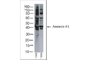 Rabbit anti Annexin A1 on human tonsil lysate (Annexin a1 anticorps)