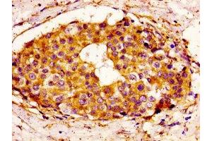 anti-B-Cell CLL/lymphoma 3 (BCL3) (AA 362-454) antibody