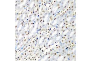 Immunohistochemistry of paraffin-embedded mouse kidney using SF3B3/S antibody (ABIN6128696, ABIN6147668, ABIN6147669 and ABIN6221751) at dilution of 1:200 (40x lens).