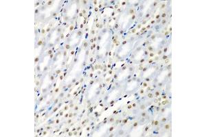 Immunohistochemistry of paraffin-embedded mouse kidney using SF3B3/S antibody (ABIN6128696, ABIN6147668, ABIN6147669 and ABIN6221751) at dilution of 1:200 (40x lens). (SF3B3 anticorps  (AA 948-1217))