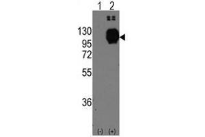 Image no. 1 for anti-Cadherin 13 (CDH13) (C-Term) antibody (ABIN356921)