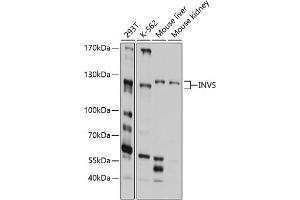 Western blot analysis of extracts of various cell lines, using INVS antibody (ABIN6129042, ABIN6142498, ABIN6142499 and ABIN6214498) at 1:1000 dilution.