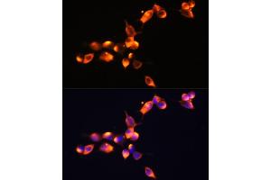 Immunofluorescence analysis of LnCap cells using KLK3 Polyclonal Antibody (ABIN3022794, ABIN3022795, ABIN3022796 and ABIN6219231) at dilution of 1:100 (40x lens).