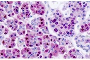 Human Pancreas: Formalin-Fixed, Paraffin-Embedded (FFPE) (NANS anticorps)