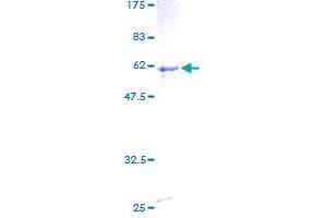 Image no. 1 for Zinc Finger and BTB Domain Containing 32 (ZBTB32) (AA 1-302) protein (GST tag) (ABIN1325600)