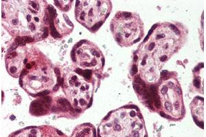 Placenta, Human: Formalin-Fixed, Paraffin-Embedded (FFPE) (USP2 anticorps  (C-Term))