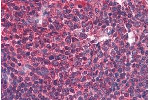 Human Tonsil: Formalin-Fixed, Paraffin-Embedded (FFPE) (BIRC3 anticorps  (AA 314-508))