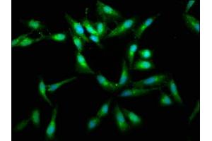 Immunofluorescence staining of Hela cells with ABIN7167060 at 1:400, counter-stained with DAPI.