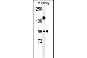 ARMC5 Antibody (C-term) (ABIN651593 and ABIN2840314) western blot analysis in mouse kidney tissue lysates (35 μg/lane). (ARMC5 anticorps  (C-Term))