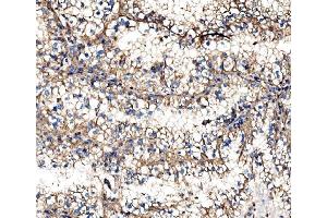 IHC analysis of IMPDH1 using anti-IMPDH1 antibody (ABIN7599864). (IMPDH1 anticorps  (AA 123-500))