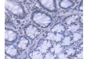 DAB staining on IHC-P; Samples: Mouse Colon Tissue (HNRNPA1 anticorps  (AA 2-320))