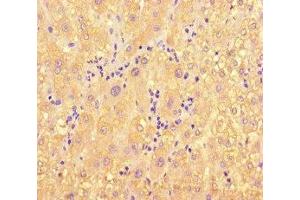 Immunohistochemistry of paraffin-embedded human liver tissue using ABIN7160996 at dilution of 1:100 (ME1 anticorps  (AA 161-519))