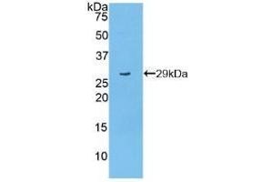Detection of Recombinant PARP, Mouse using Polyclonal Antibody to Poly ADP Ribose Polymerase (PARP) (PARP1 anticorps  (AA 661-881))