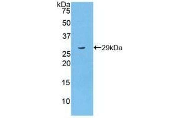 PARP1 anticorps  (AA 661-881)