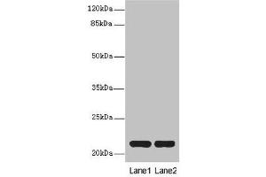 Western blot All lanes: CXXC4antibody at 3.