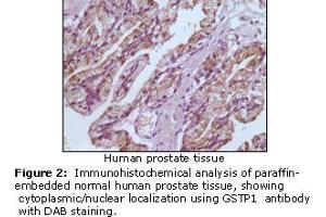 Image no. 1 for anti-Glutathione S-Transferase pi 1 (GSTP1) antibody (ABIN207627) (GSTP1 anticorps)
