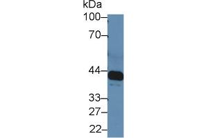 Western blot analysis of Rat Serum, using Rat IL6R Antibody (5 µg/ml) and HRP-conjugated Goat Anti-Rabbit antibody ( (IL-6 Receptor anticorps  (AA 214-348))