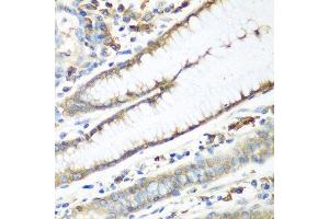 Immunohistochemistry of paraffin-embedded human stomach using CAD antibody.