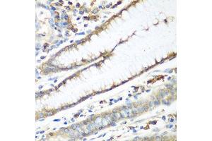 Immunohistochemistry of paraffin-embedded human stomach using CAD antibody. (CAD anticorps  (AA 1650-1900))