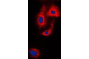 Immunofluorescent analysis of VASP staining in HepG2 cells. (VASP anticorps  (Center))