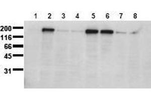 Western Blotting (WB) image for anti-Epidermal Growth Factor Receptor (EGFR) (pSer1071) antibody (ABIN126767)