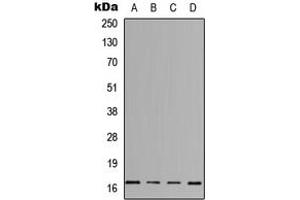 Western blot analysis of IL-3 expression in HeLa (A), Jurkat (B), Raw264. (IL-3 anticorps  (Center))