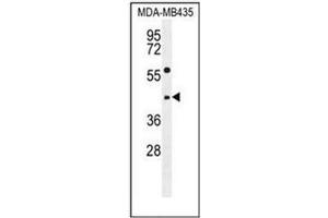 Western blot analysis of ABHD9 Antibody (C-term) in MDA-MB435 cell line lysates (35ug/lane). (ABHD9 anticorps  (C-Term))