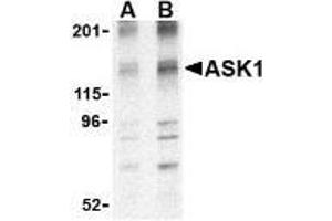 Western blot analysis of ASK1 in 3T3 cell lysate with AP30087PU-N ASK1 antibody at (A) 1 and (B) 2 μg/ml. (ASK1 anticorps  (N-Term))