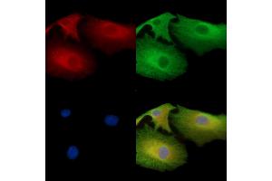 NCE2 Antibody staining A549 cells by IF/ICC.