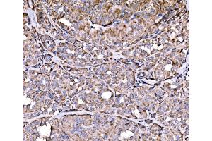 IHC analysis of RPL17 using anti-RPL17 antibody (ABIN7601639).