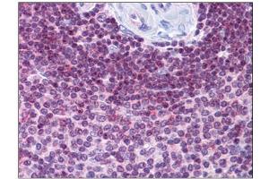 Human Spleen: Formalin-Fixed, Paraffin-Embedded (FFPE)