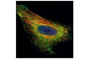 ICC/IF Image Confocal immunofluorescence analysis (Olympus FV10i) of paraformaldehyde-fixed HeLa, using TIP30, antibody (Green) at 1:500 dilution.