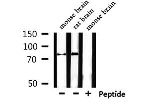 Western blot analysis of extracts from mouse brain,rat brain, using Mitofusin Antibody. (MFN1 anticorps  (Internal Region))