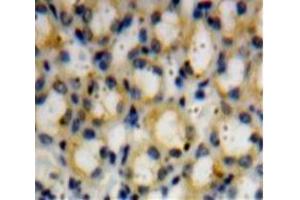 Used in DAB staining on fromalin fixed paraffin-embedded Kidney tissue (Dymeclin anticorps  (AA 546-669))