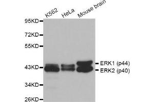 Western blot analysis of extracts of various cell lines, using ERK1/2 antibody. (ERK2 anticorps  (AA 200-300))