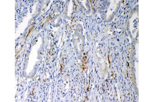 IHC analysis of VEGFD using anti-VEGFD antibody .