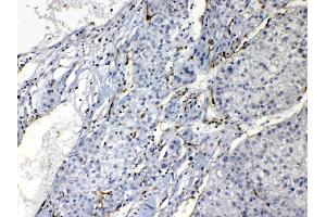 IHC analysis of PNP using anti-PNP antibody .