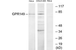 Western blot analysis of extracts from HeLa/COLO205 cells, using GPR149 Antibody. (GPR149 anticorps  (AA 451-500))