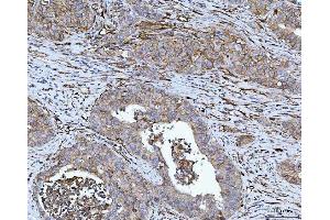 IHC analysis of CD276 using anti-CD276 antibody (ABIN7601136).