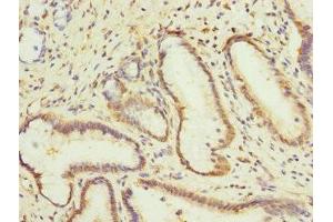 Immunohistochemistry of paraffin-embedded human pancreatic tissue using ABIN7146772 at dilution of 1:100 (CPD anticorps  (AA 860-1100))