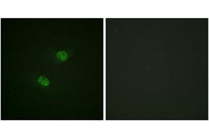 Immunofluorescence analysis of HeLa cells, using CDC16/APC6 (Phospho-Ser560) Antibody. (CDC16 anticorps  (pSer560))