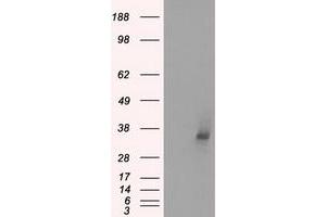 Image no. 5 for anti-Lactate Dehydrogenase A (LDHA) antibody (ABIN1499114)