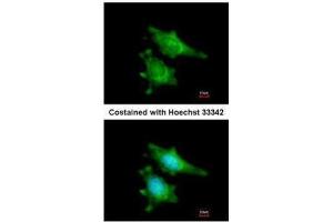 ICC/IF Image Immunofluorescence analysis of methanol-fixed HeLa, using RIP2, antibody at 1:200 dilution. (RIPK2 anticorps)