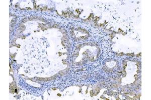 IHC analysis of FOXK1 using anti-FOXK1 antibody (ABIN7600295). (Foxk1 anticorps  (AA 175-671))