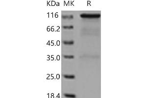 Western Blotting (WB) image for Receptor tyrosine-protein kinase erbB-2 (ErbB2/Her2) protein (Fc Tag) (ABIN7321223)