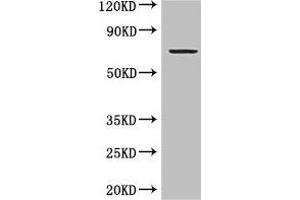 Western Blot Positive WB detected in: MCF-7 whole cell lysate All lanes: GRAMD4 antibody at 5 μg/mL Secondary Goat polyclonal to rabbit IgG at 1/50000 dilution Predicted band size: 67, 11 kDa Observed band size: 67 kDa