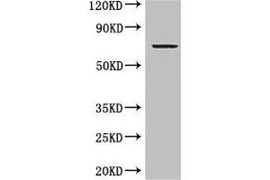 Western Blot Positive WB detected in: MCF-7 whole cell lysate All lanes: GRAMD4 antibody at 5 μg/mL Secondary Goat polyclonal to rabbit IgG at 1/50000 dilution Predicted band size: 67, 11 kDa Observed band size: 67 kDa (GRAMD4 anticorps  (AA 23-161))