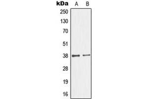 Western blot analysis of GIMAP4 expression in Jurkat (A), HeLa (B) whole cell lysates.